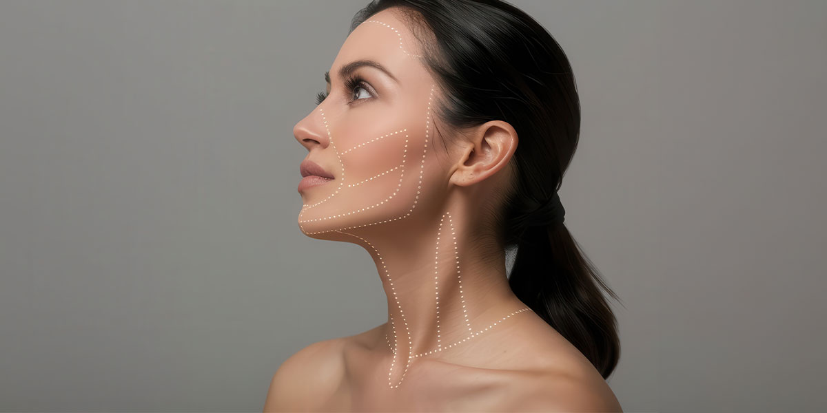 Face and Neck Lift 